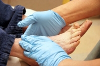 Foot Pain in Diabetic Patients