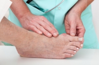 Bunions: An Acquired Yet Correctable Deformity