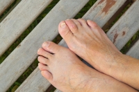 Why Treating a Hammertoe Promptly is Important